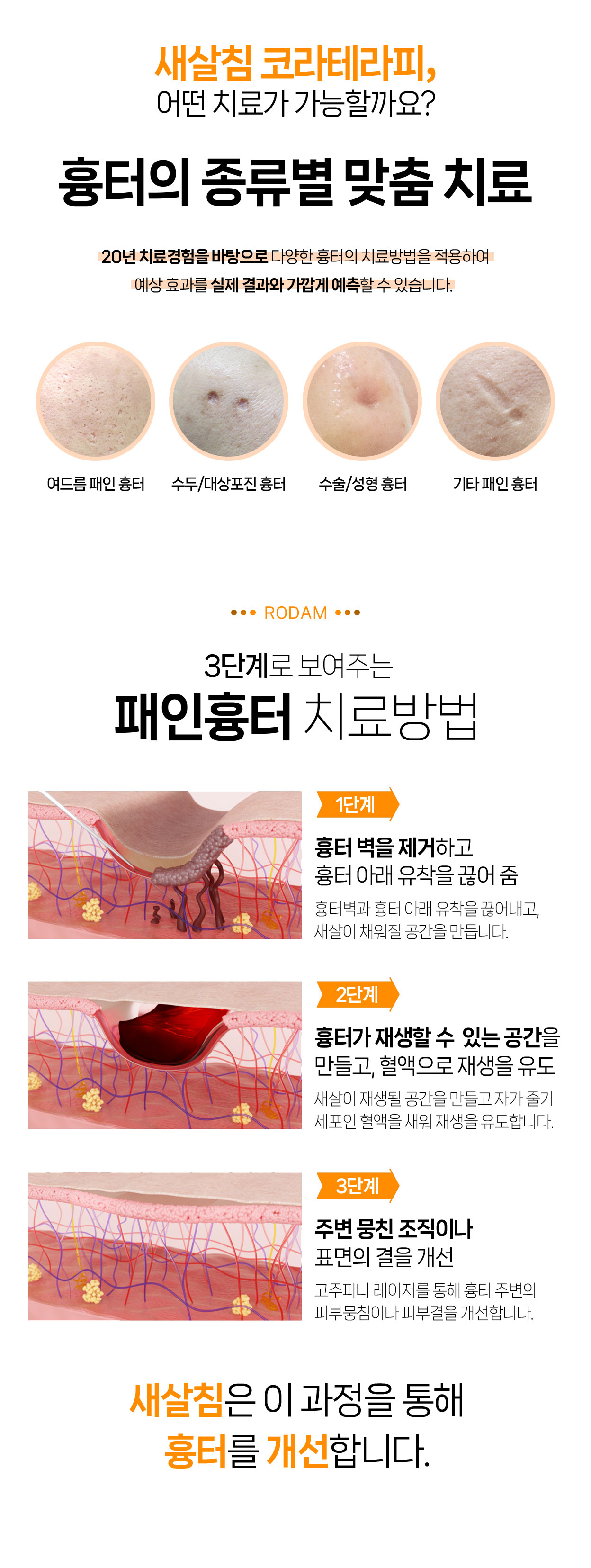 로담한의원 부산점입니다. 새살침으로 부산여드름흉터, 부산수두흉터, 부산성형흉터, 부산수술흉터, 부산얼굴패인흉터를 집중해서 치료합니다. 부산새살침치료, 부산한방피부과, 부산점 로담한의원 새살침 코라테라피가 시작된 곳